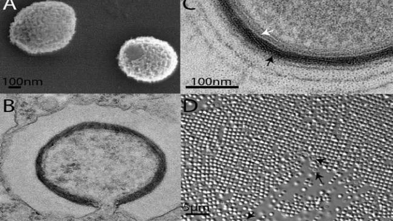 Imagens de microscopia eletrônica do Mollivirus sibericum