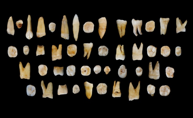 Estes 47 dentes humanos, com 80 a, 120 mil anos, foram encontrados num sistema de grutas de calcário em Daoxian, na China