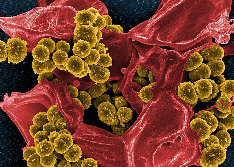 Staphylococcus aureus, uma superbacteria resistente aos antibióticos