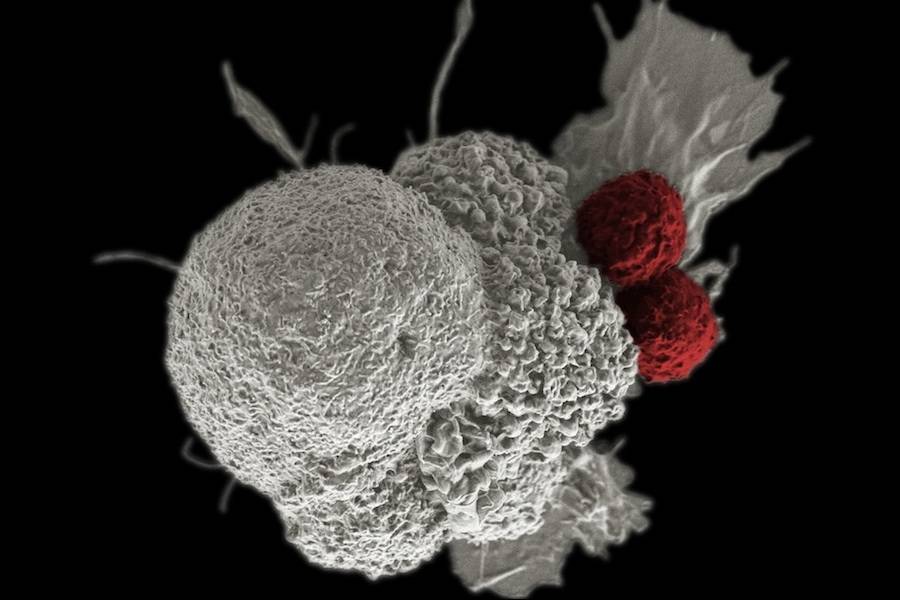 Célula cancerígena (a branco) sendo atacada por dois linfócitos T citotóxicos (a vermelho) num processo natural de resposta imune