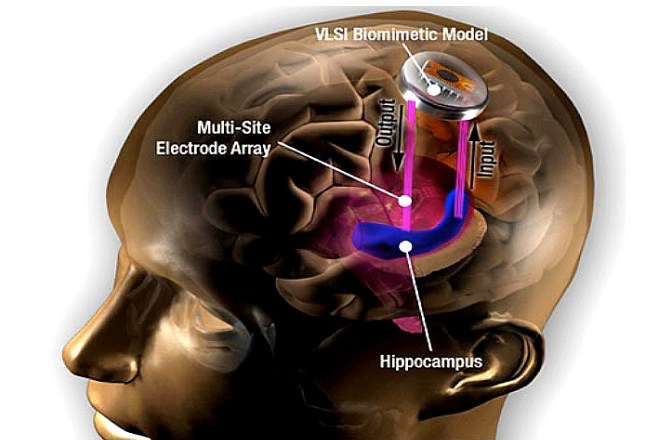 O hipocampo é uma região chave do cºerebro, envolvida na formação e armazenamento da memória