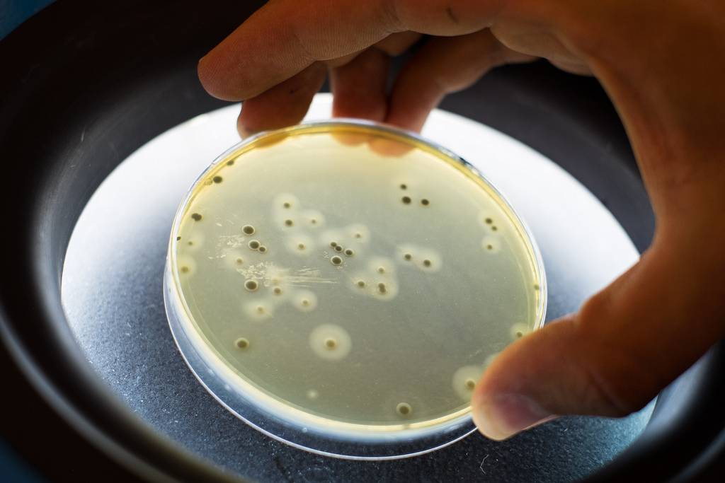 Bactérias Staphylococcus aureus numa placa de Petri
