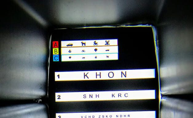 Robô pode evitar até 750 mil casos de cegueira no Brasil