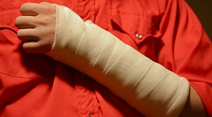 O ‘gesso do futuro’ já existe e é impermeável, ventilado e não dá coceira