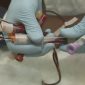 Sangue do cordão umbilical facilita recuperação no período pós-transplante