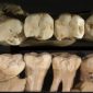 Neandertais praticavam um tipo de “odontologia pré-histórica”