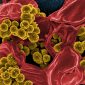 Novos antibióticos combatem superbactéria sem efeito colateral
