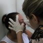 Casos de sífilis voltam a aumentar no Brasil