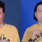 O sucesso do primeiro transplante de rosto e de mãos em vítima de acidente